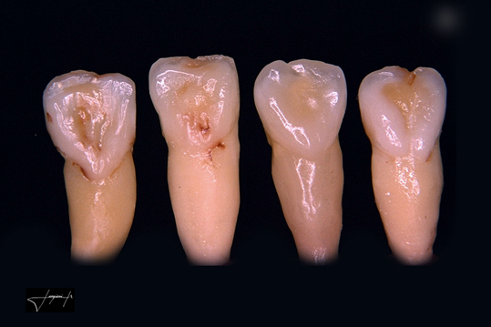 Laboratório Prologic cerâmica odontológica