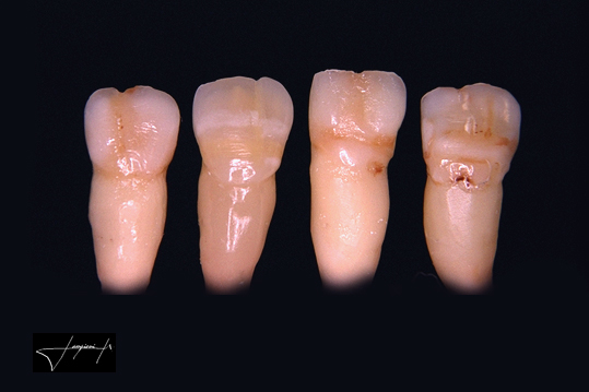 Laboratório Prologic cerâmica odontológica