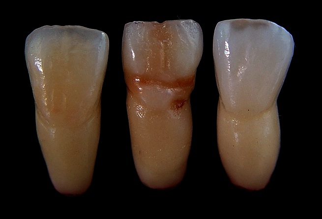 Laboratório Prologic cerâmica odontológica