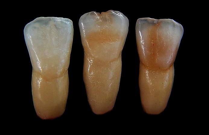 Laboratório Prologic cerâmica odontológica