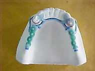 Prótese Odontológica - PPR