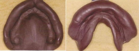 ´Prótese dentária odontológica Godiva