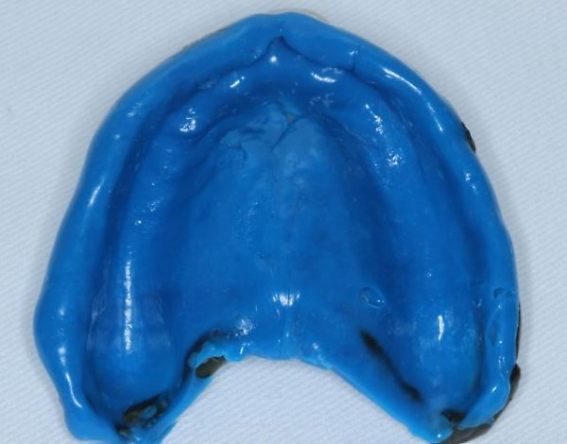 ´Prótese dentária odontológica Silicone