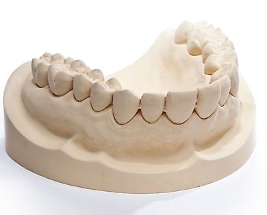 Prótese Odontológica - gessos